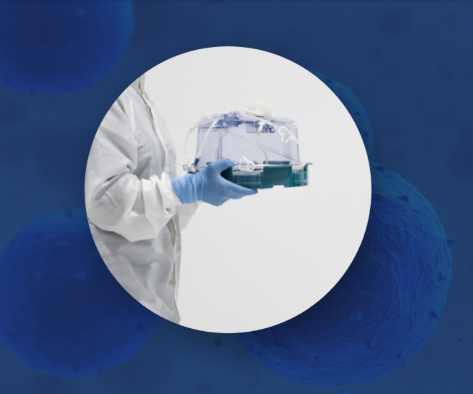 G-Rex® closed-system bioreactors: Predictable, scalable cell expansion