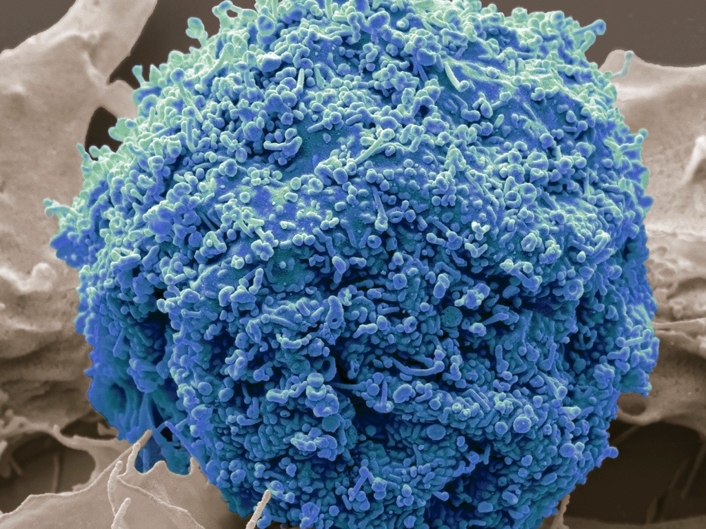 Comparing cellular delivery mechanisms: Exosomes, viral vectors, and nanoparticles